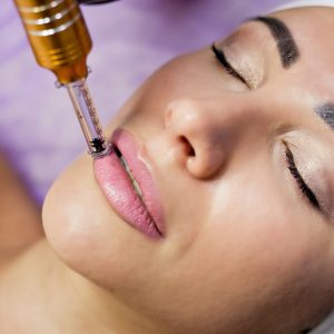 Hyaluron Pen 3 SESIONES